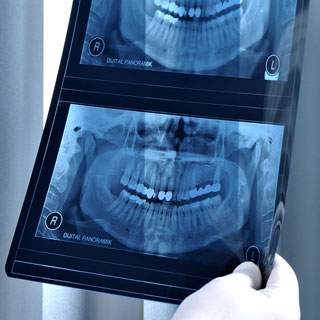 Dr. Jack S. Roth, DDS PC, uses digital radiography for his endodontics practice in New York City.